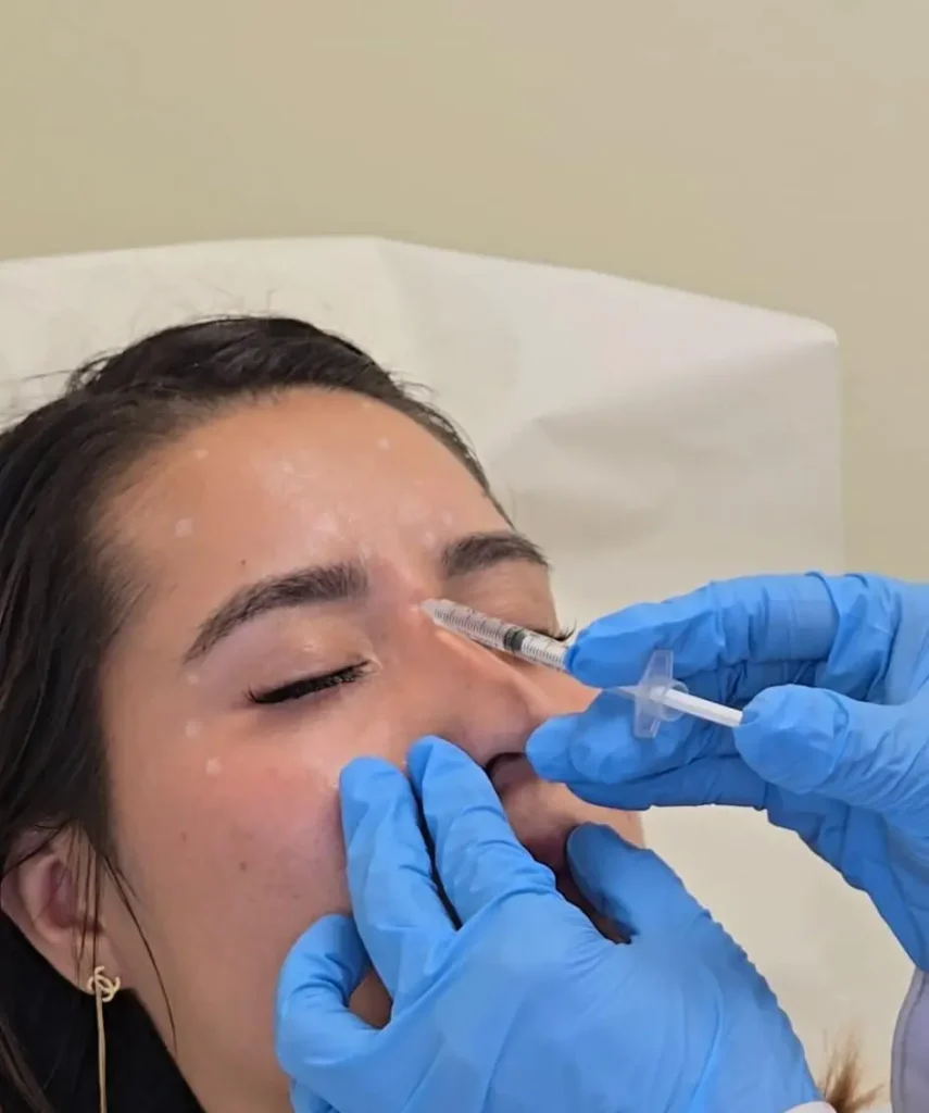 Botox in Cape Coral, FL at KYSA Cosmetic Clinic