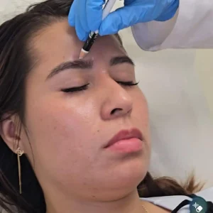 kysa-cosmetic-aesthetic-clinic-botox-preparation