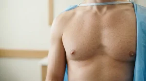kysa-cosmetic-aesthetic-clinic-Man_chest_clinical_examination
