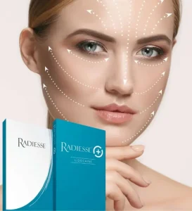 kysa-cosmetic-aesthetic-clinic-radiesse-cape-coral