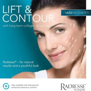 kysa-cosmetic-aesthetic-clinic-radiesse-results
