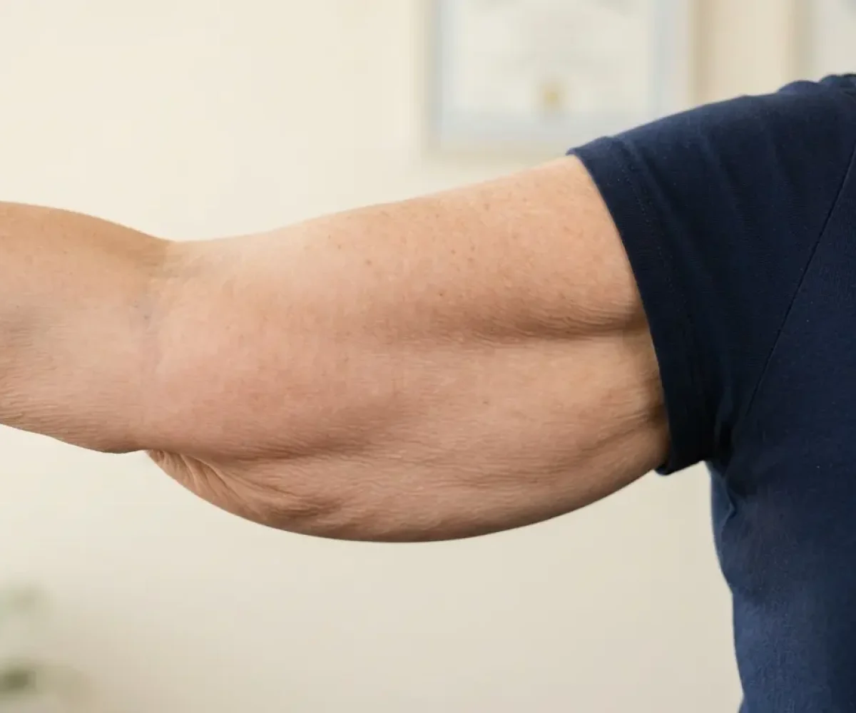 kysa-cosmetic-aesthetic-clinic-woman-holding-arm-horizontally-brachioplasty